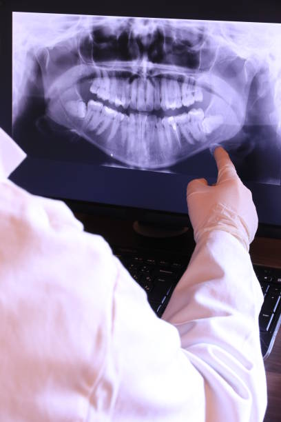 Best Emergency Dentist for Knocked-Out Tooth in Earlham, IA